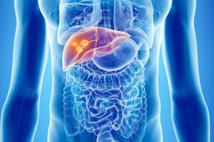 Метастатический рак печени: причины возникновения и основные симптомы, способы лечения заболевания