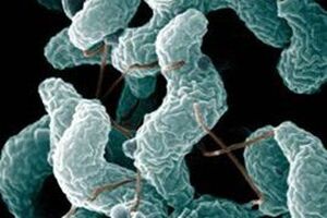 Кампилобактериоз: причини виникнення та основні симптоми, способи лікування захворювання