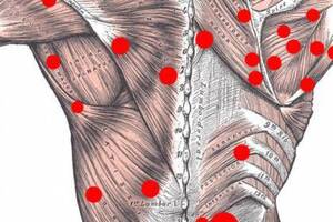Миофасциальный болевой синдром: причины возникновения и основные симптомы, способы лечения заболевания