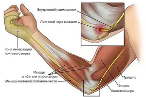 бабло забыли воспалился локтевой сустав чем лечить очень забавная
