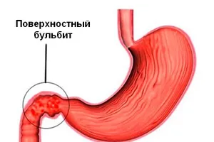 после обезболивающих болит желудок