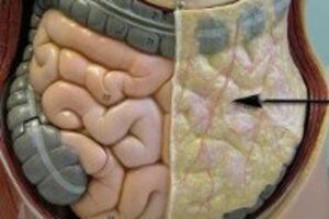 Оментит: причини виникнення та основні симптоми, способи лікування захворювання