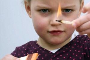 Ожоги у детей: причины возникновения и основные симптомы, способы лечения заболевания