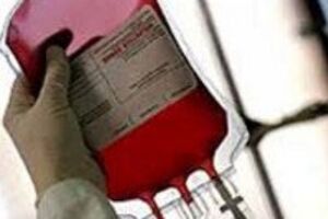 Острая кровопотеря: причины возникновения и основные симптомы, способы лечения заболевания