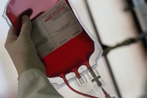 Синдром массивной гемотрансфузии: причини виникнення та основні симптоми, способи лікування захворювання