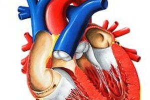 Синдром гипоплазии левых отделов сердца: причины возникновения и основные симптомы, способы лечения заболевания