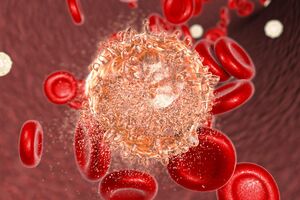 Рак крови: причины возникновения и основные симптомы, способы лечения заболевания