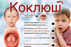 Коклюш: причины возникновения и основные симптомы, способы лечения заболевания