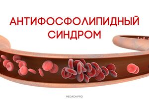 Антифосфолипидный синдром: причины возникновения и основные симптомы, способы лечения заболевания