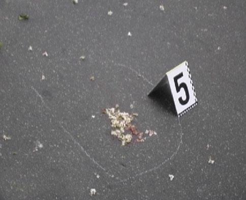 Депутата Омельченка збила машина. Фоторепортаж