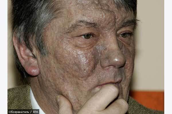 Кто отравил Ющенко? - 4 