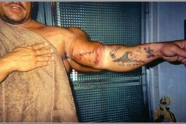 Страшные жертвы допинга (фото) 