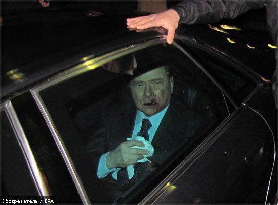 Берлусконі належить лікуватися не один тиждень (ФОТО)