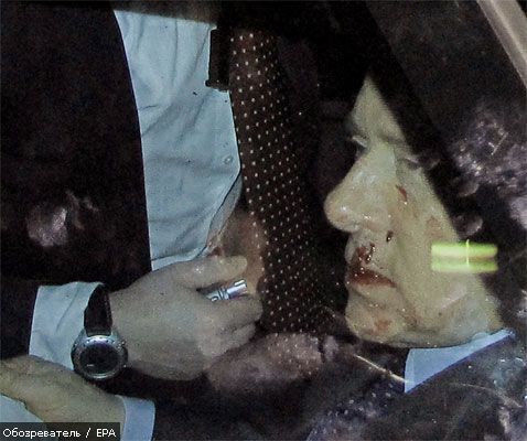 Берлусконі належить лікуватися не один тиждень (ФОТО)