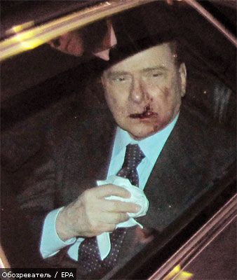 Берлусконі належить лікуватися не один тиждень (ФОТО)