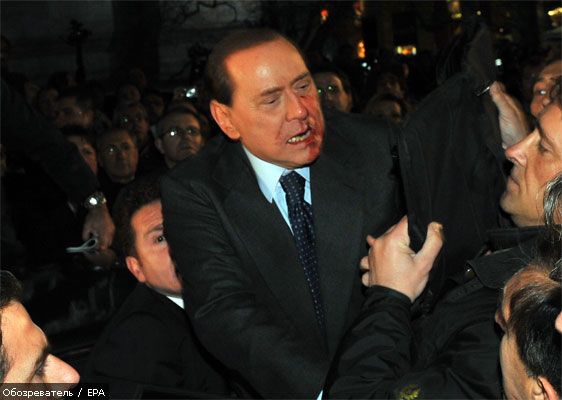 Берлусконі належить лікуватися не один тиждень (ФОТО)