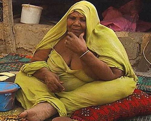 Африку охватила эпидемия ожирения из-за бедности. ФОТО