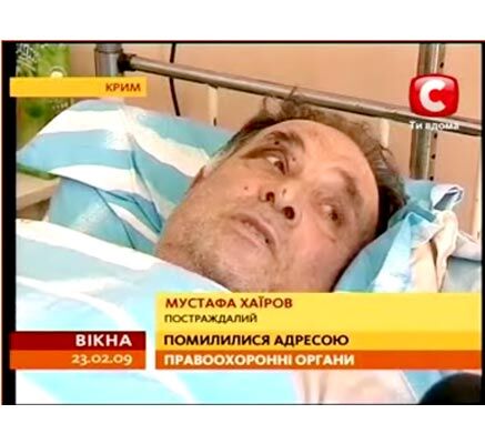 За відірвану руку на" орлів" Луценка завели кримінал