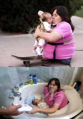 Жінка з половиною тіла народила двох дітей