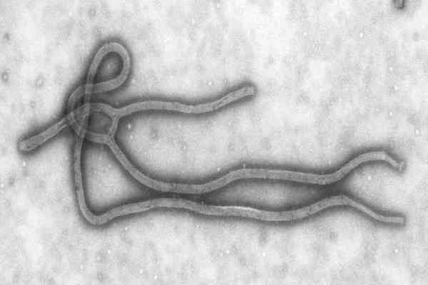Лаборанта-микробиолога поймали с ампулами вируса Эбола