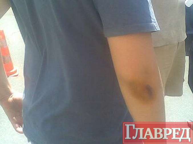 Разъезжая по двору, девушка сбила ребенка