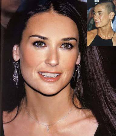 Деми Мур рассказала о своих пластических операциях