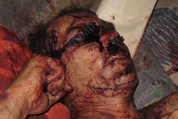 Жертве вырезали глаза, чтобы она не узнала грабителей (ФОТО)