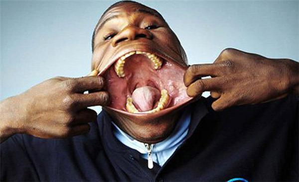 Найбільший рот в світі. ФОТО