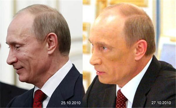 Синяк и мрачное настроение: Путин только сделал пластику?