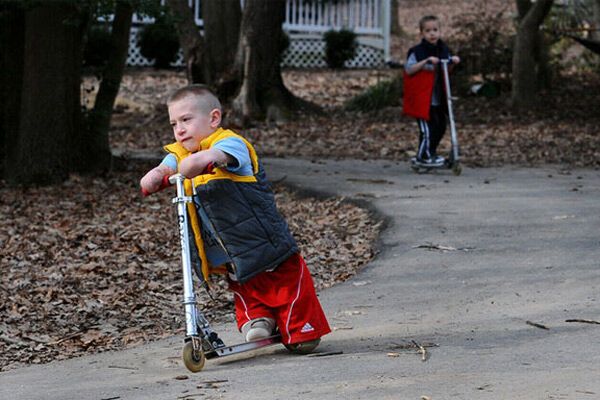 Без рук, без ног, но с огромным сердцем. Поражающие ФОТО
