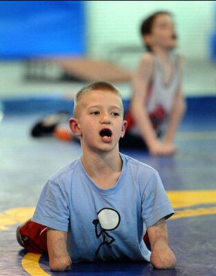 Без рук, без ног, но с огромным сердцем. Поражающие ФОТО