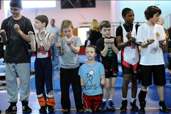 Без рук, без ног, но с огромным сердцем. Поражающие ФОТО