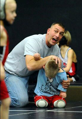 Без рук, без ног, но с огромным сердцем. Поражающие ФОТО