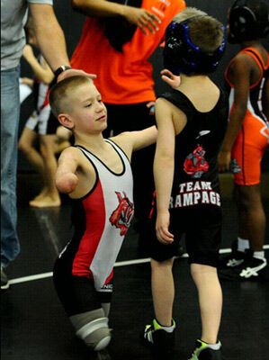 Без рук, без ног, но с огромным сердцем. Поражающие ФОТО