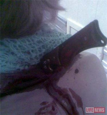 Девушка пришла домой с ножом в позвоночнике (ФОТО)
