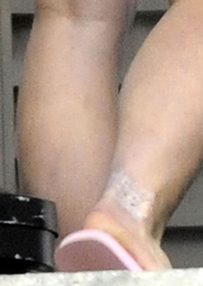 На одной из ног певицы красуется странное пятно