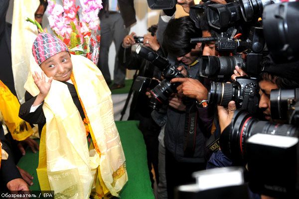 Непалец может стать самым маленьким человеком в мире (ФОТО)