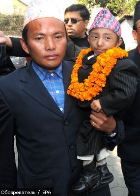 Непалец может стать самым маленьким человеком в мире (ФОТО)