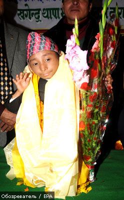 Непалец может стать самым маленьким человеком в мире (ФОТО)