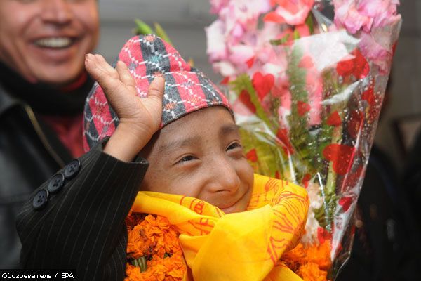 Непалец может стать самым маленьким человеком в мире (ФОТО)