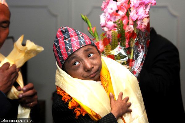 Непалец может стать самым маленьким человеком в мире (ФОТО)