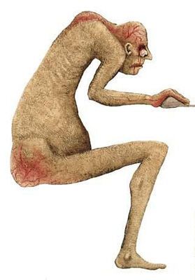 Не высиживай в кресле смерть! Сидячие болезни