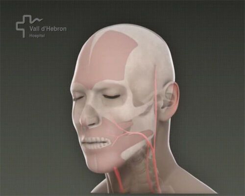 Вперше у світі проведена повна пересадка обличчя. ФОТО і ВІДЕО