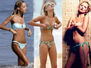 Костлявые звезды-анорексички