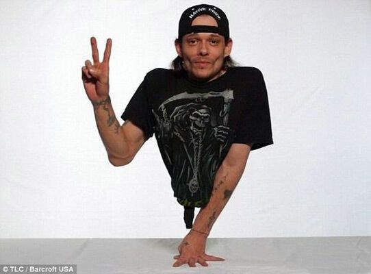 Кенни - человек-полтела. ФОТО и ВИДЕО