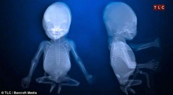 Кенни - человек-полтела. ФОТО и ВИДЕО