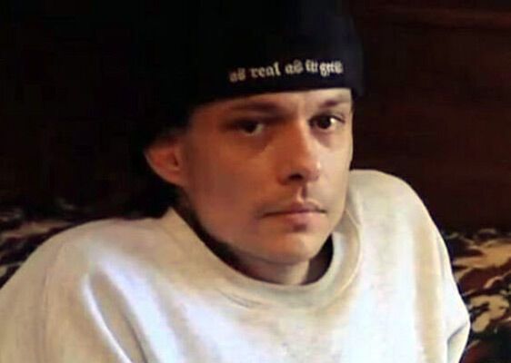 Кенни - человек-полтела. ФОТО и ВИДЕО