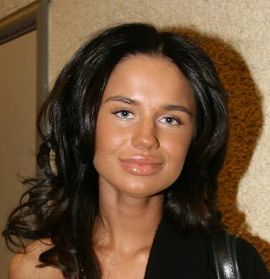 Певица Алекса с трудом разговаривает из-за пластики губ