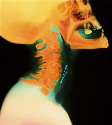 Самые странные и удивительные рентгеновские снимки