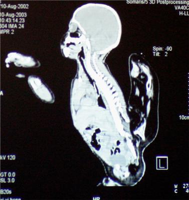 Самые странные и удивительные рентгеновские снимки